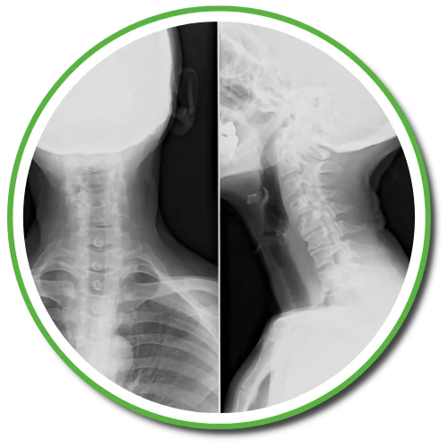 Gonstead X-rays